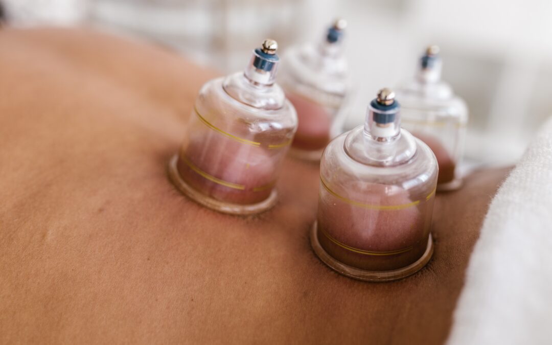 The Benefits of Adding Cupping to your next Massage